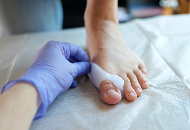 Eine Hand im Handschuh legt ein weißes Silikonpolster an den großen Zeh eines Fußes an